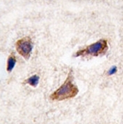 IHC analysis of FFPE human brain tissue stained with CAMKK2 antibody