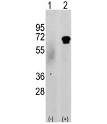 Western blot analysis of CAMKK2 antibody and 293 cell lysate either nontransfected (c) or transiently transfected with the CAMKK2 gene (2). Predicted molecular weight 60-65 kDa.~