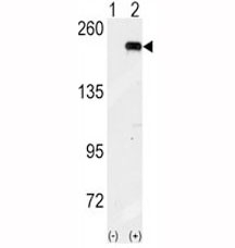 Western blot analysis of GCN2 antibody and 293 cell lysate (2 ug/lane) either nontransfected (Lane 1) or transiently transfected with the GCN2 gene (2).~