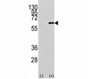 Western blot analysis of AKT1 antibody and 293 cell lysate (2 ug/lane) either nontransfected (Lane 1) or transiently transfected with the human gene (2).