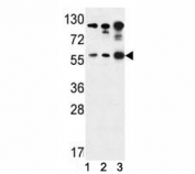 AKT1 antibody western blot analysis in (1) Jurkat, (2) A375, and (3) Y79 lysate