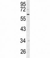 Western blot analysis of RIPK3 antibody and Ramos lysate. Predicted molecular weight ~57 kDa.