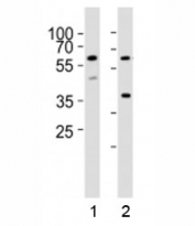 Western blot analysis of lysate from 1) HT-29 and 2) K562 cell lines using RIPK3 antibody at 1:1000. Predicted molecular weight ~57 kDa.