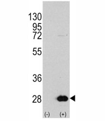 Western blot analysis of HSPB1 antibody and 293 cell lysate either nontransfected (Lane 1) or transiently transfected with the HSPB1 gene (2).~