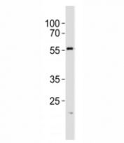 Western blot analysis of lysate from A431 cell line using SPHK1 antibody at 1:1000. Predicted molecular weight: ~43/51/44kDa (isoforms 1/2/3).