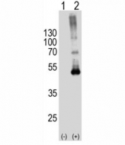Western blot analysis of SPHK1 antibody and 293T cell lysate either nontransfected (Lane 1) or transiently transfected (2) with the SPHK1 gene. Predicted molecular weight: ~43/51/44kDa (isoforms 1/2/3).