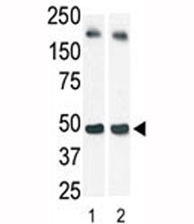 The SphK1 antibody used in western blot (lane 2) to detect c-myc-tagged SphK1 in transfected 293 cell lysate (a c-myc antibody is used as control in Lane 1). Predicted molecular weight: 42-51 kDa.