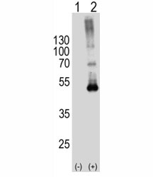 Western blot analysis of SPHK1 antibody and 293T cell lysate either nontransfected (Lane 1) or transiently transfected (2) with the SPHK1 gene. Predicted molecular weight: 42-51 kDa.