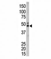 The SPHK1 antibody used in western blot to detect SPHK1 in mouse kidney tissue lysate. Predicted molecular weight: ~43/51/44kDa (isoforms 1/2/3).