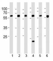 Western blot analysis of lysate from 1) 293, 2) HepG2, 3) HUVEC, 4) Raji, 5) rat C6 and 6) mouse C2C12 cell line using SPHK1 antibody at 1:1000. Predicted molecular weight: ~43/51/44kDa (isoforms 1/2/3).