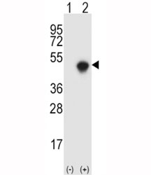 Western blot analysis of SPHK1 antibody and 293 cell lysate either nontransfected (Lane 1) or transiently transfected (2) with the SPHK1 gene.