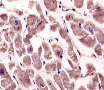 IHC analysis of FFPE human heart tissue stained with the SPHK1 antibody. HIER: boil tissue sections in pH6, 10mM citrate buffer, for 20 min and allow to cool before testing.