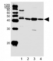 Western blot analysis of lysate from 1) HepG2 cell line and human 2) heart, 3) skeletal muscle, 4) kidney tissue using SPHK1 antibody at 1:1000. Predicted molecular weight: ~43/51/44kDa (isoforms 1/2/3).