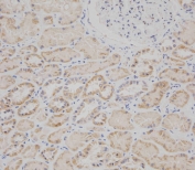 IHC analysis of FFPE human kidney tissue stained with the SPHK2 antibody. HIER: boil tissue sections in pH6, 10mM citrate buffer, for 20 min and allow to cool before testing.