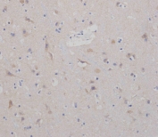 IHC analysis of FFPE human brain tissue stained with the SPHK2 antibody. HIER: boil tissue sections in pH6, 10mM citrate buffer, for 20 min and allow to cool before testing.