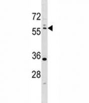 LKB1 antibody western blot analysis in T47D lysate. Predicted molecular weight: 50~60 kDa