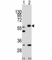 Western blot analysis of LKB1 antibody and 293 cell lysate (2 ug/lane) either nontransfected (Lane 1) or transiently transfected with the STK11 gene (2). Predicted molecular weight: 50~60 kDa