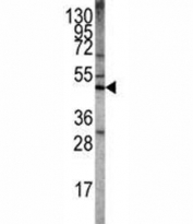 Western blot analysis of LKB1 antibody and Ramos lysate. Predicted molecular weight: 50~60 kDa