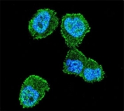 Confocal immunofluorescent analysis of LKB1 antibody with ZR-75-1 cells followed by Alexa Fluor 488-conjugated goat anti-rabbit lgG (green). DAPI was used as a nuclear counterstain (blue).