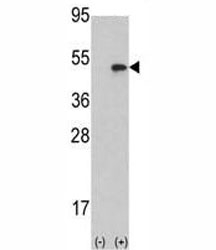 Western blot analysis of Aurora B antibody and 293 cell lysate (2 ug/lane) either nontransfected (Lane 1) or transiently transfected with the AURKB gene (2). Predicted molecular weight: 39-45 kDa