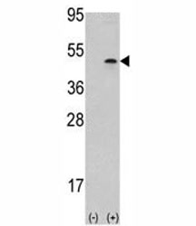 Western blot analysis of Aurora B antibody and 293 cell lysate (2 ug/lane) either nontransfected (Lane 1) or transiently transfected with the AURKB gene (2).~