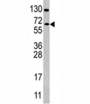 Western blot analysis of CDC25B antibody and Ramos lysate. Expected/observed molecular weight: 61~67kDa (isoforms 1-4).
