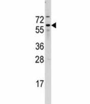 Western blot analysis of Cdc25B antibody and A2058 lysate