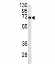 Western blot analysis of CDC25B antibody and Ramos lysate. Expected/observed molecular weight: 61~67kDa (isoforms 1-4).