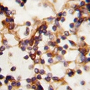 IHC analysis of FFPE human lymph tissue stained with RICTOR antibody
