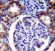 RICTOR antibody immunohistochemistry analysis in formalin fixed and paraffin embedded human kidney tissue.