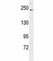 RICTOR antibody western blot analysis in mouse bladder tissue lysate. Predicted molecular weight ~200 kDa