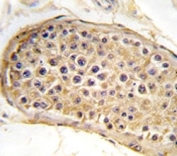 IHC analysis of FFPE human testis tissue stained with RICTOR antibody