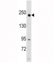 Western blot analysis of RICTOR antibody and SK-BR-3 lysate.