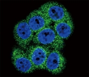 Confocal immunofluorescent analysis of DDR1 antibody with 293 cells followed by Alexa Fluor 488-conjugated goat anti-rabbit lgG (green). DAPI was used as a nuclear counterstain (blue).