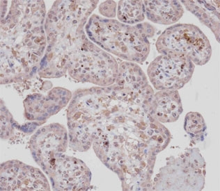 IHC testing of FFPE human placental tissue with DDR1 antibody. HIER: steam section in pH9 EDTA buffer for 20 min and allow to cool prior to staining.