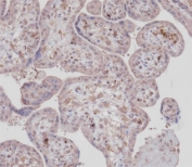 IHC testing of FFPE human placental tissue with DDR1 antibody. HIER: steam section in pH9 EDTA buffer for 20 min and allow to cool prior to staining.