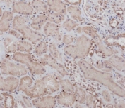 IHC testing of FFPE human kidney tissue with DDR1 antibody. HIER: steam section in pH9 EDTA buffer for 20 min and allow to cool prior to staining.