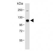 Western blot testing of human A431 cell lysate with DDR1 antibody. Expected molecular weight: 100~125 kDa.