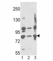 Western blot analysis of Neprilysin antibody and 1) A2058, 2) A375, 3) Ramos lysate.