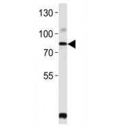 Western blot analysis of lysate from SW480 cell line using PCSK9 antibody. Predicted size: Pro/mature ~74/64 kDa