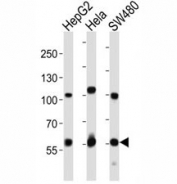 Western blot analysis of lysate from HepG2, HeLa, SW480 cell line using PCSK9 antibody. Predicted size: Pro/mature ~74/64 kDa