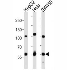 Western blot analysis of lysate from HepG2, HeLa, SW480 cell line using PCSK9 antibody. Predicted size: Pro/mature ~74/64 kDa