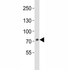 Western blot analysis of lysate from HepG2 cell line using anti-PCSK9 antibody at 1:1000. Predicted size: Pro/mature ~74/64 kDa