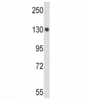 Western blot analysis of CP antibody and mouse lung tissue lysate. Predicted molecular weight ~130 kDa.