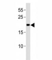 MGMT antibody western blot analysis in Jurkat lysate.