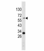 Western blot analysis of Tyrosinase antibody and HepG2 lysate.