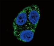 Confocal immunofluorescent analysis of Tyrosinase antibody with HepG2 cells followed by Alexa Fluor 488-conjugated goat anti-rabbit lgG (green). DAPI was used as a nuclear counterstain (blue).