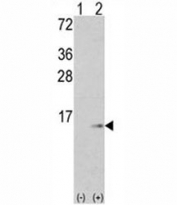 Western blot analysis of S100A6 antibody and 293 cell lysate (2 ug/lane) either nontransfected (Lane 1) or transiently transfected with the S100A6 gene (2).