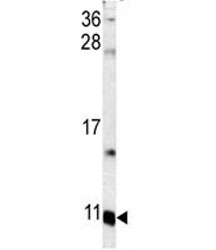 Western blot analysis of S100A6 antibody and mouse lung tissue lysate.