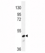 Western blot analysis of SMAD2 antibody and NIH3T3 lysate. Predicted molecular weight: 52~60 kDa.